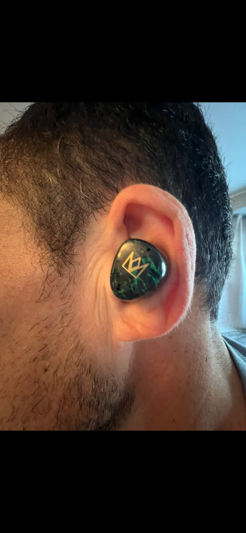 Going fully Wireless IEMs. Too soon? Or are we there yet? | Page 4930 ...